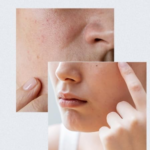 anua-birch-70-moisture-boosting-serum-30ml-aucobirichboostingserumxxv-30ml-secondary-03.png Anua - Birch 70 Moisture Boosting Serum - additional product view 3 - wholesale