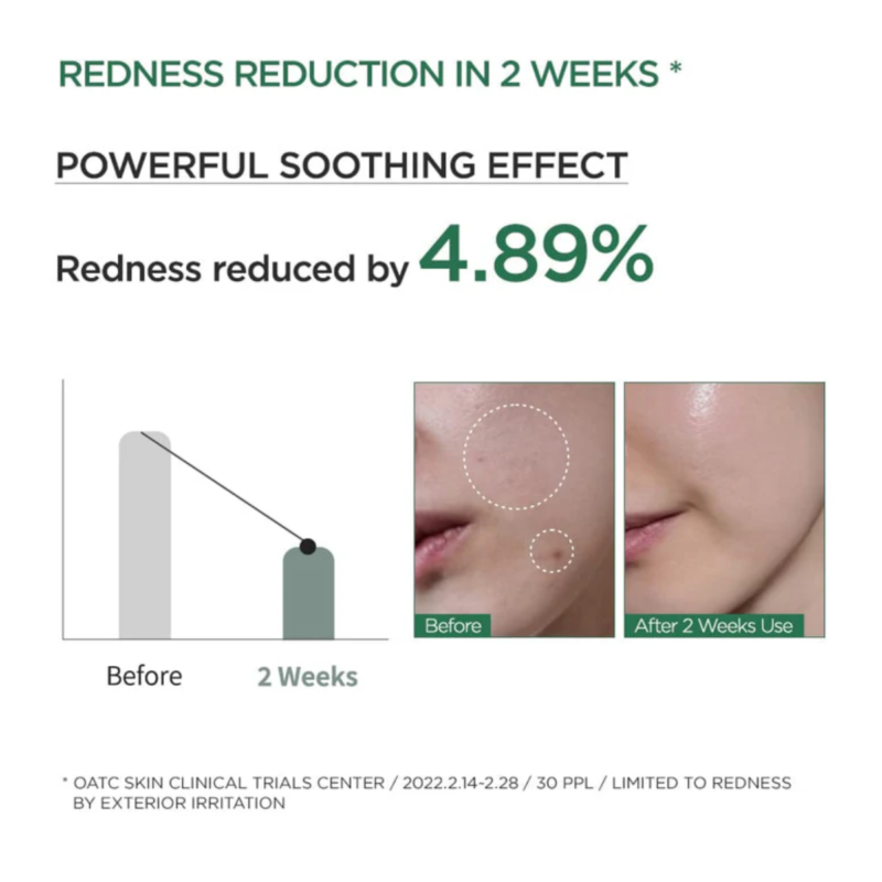 Anua - Heartleaf 80 Moisture Soothing Ampoule - additional product view 4 - wholesale