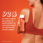 Bio-Oil - Skincare Oil - additional product view 3 - wholesale