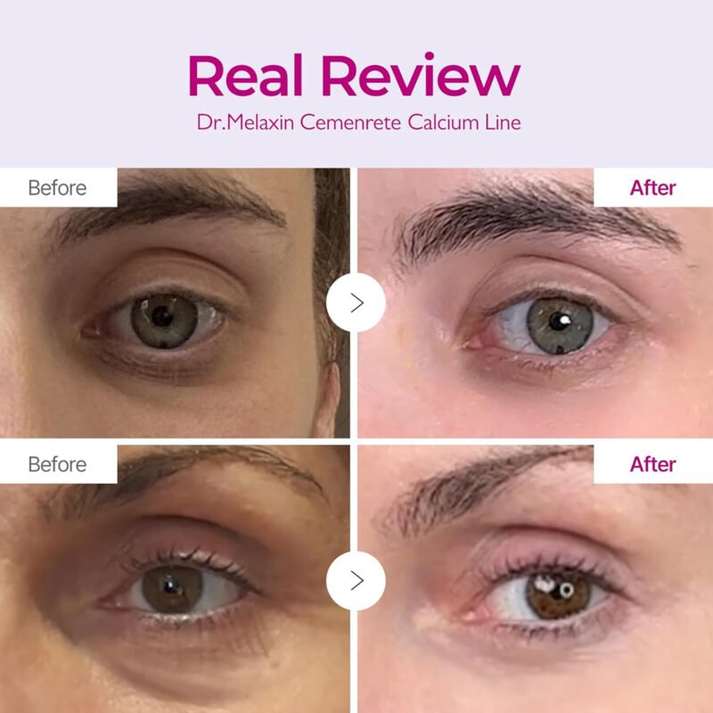 Dr. Melaxin – Calcium Intense Cream EX Volume Firming - additional product view 3 - wholesale