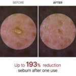 DR . MELAXIN - EXFOLIANT BLACK RICE AMPOULE - additional product view 3 - wholesale