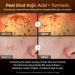 Dr.Melaxin - Exfoliating Serum with Kojic Acid and Turmeric - additional product view 3 - wholesale