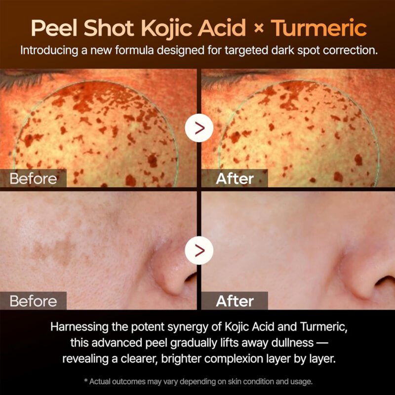 Dr.Melaxin - Exfoliating Serum with Kojic Acid and Turmeric - additional product view 3 - wholesale