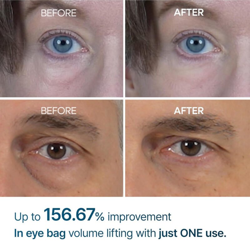 Dr. Melaxin – Eyehalt Eye Cream - additional product view 3 - wholesale