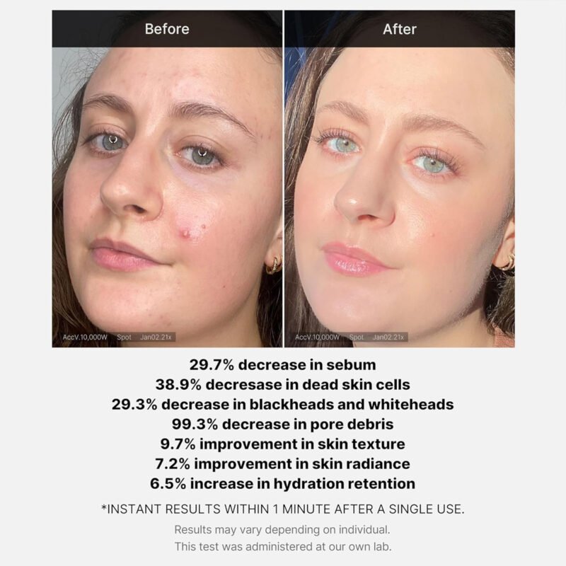 Medicube - Red Succinic Acid Peel - additional product view 4 - wholesale